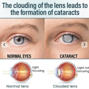 Alternative view of Elycura™ NANO Eye Drops
