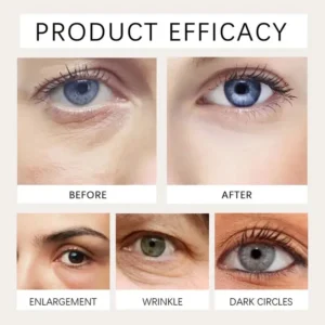 Elycura™: The Instant Eye Lift That Doesn't Betray You When You Smile